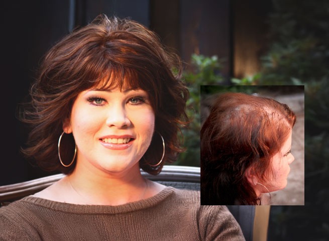 pk walsh trichologist hair loss solutions boston massachusetts womens hair loss solutions boston providence