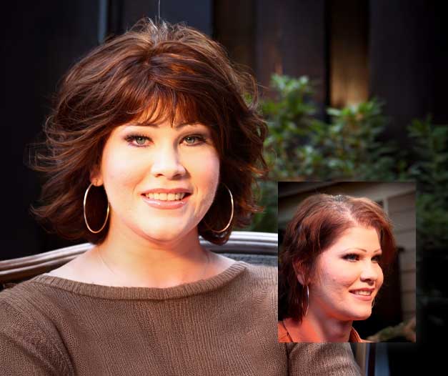 womens non-surgical hair replacement Boston