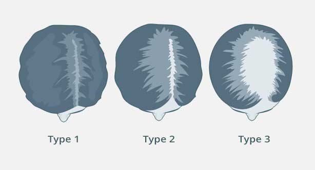 medical hair loss women boston ma