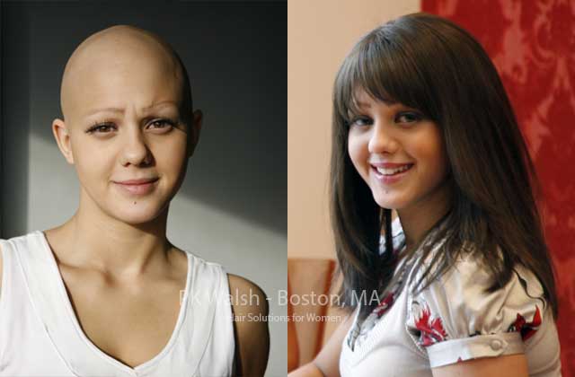 Women's custom wigs for Alopecia PK Walsh