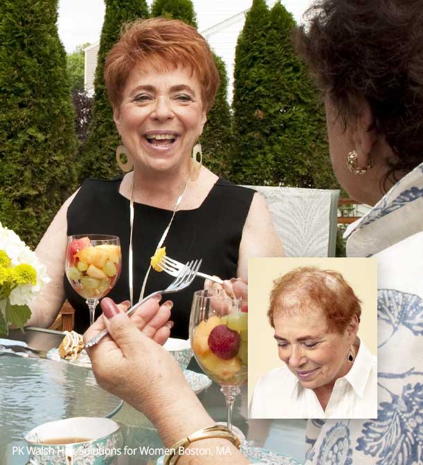 Before and after photos of women’s non-surgical hair replacement showing restored fullness and natural-looking results at PK Walsh in Boston.
