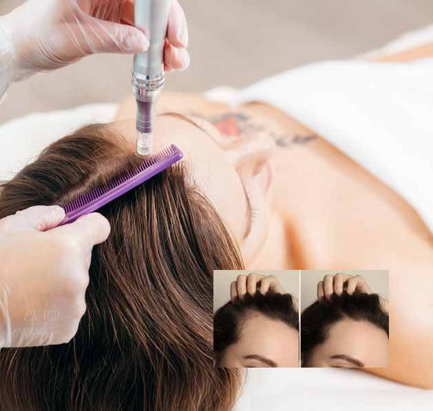 PRP hair loss treatment for women Boston at PK Walsh Boston MA