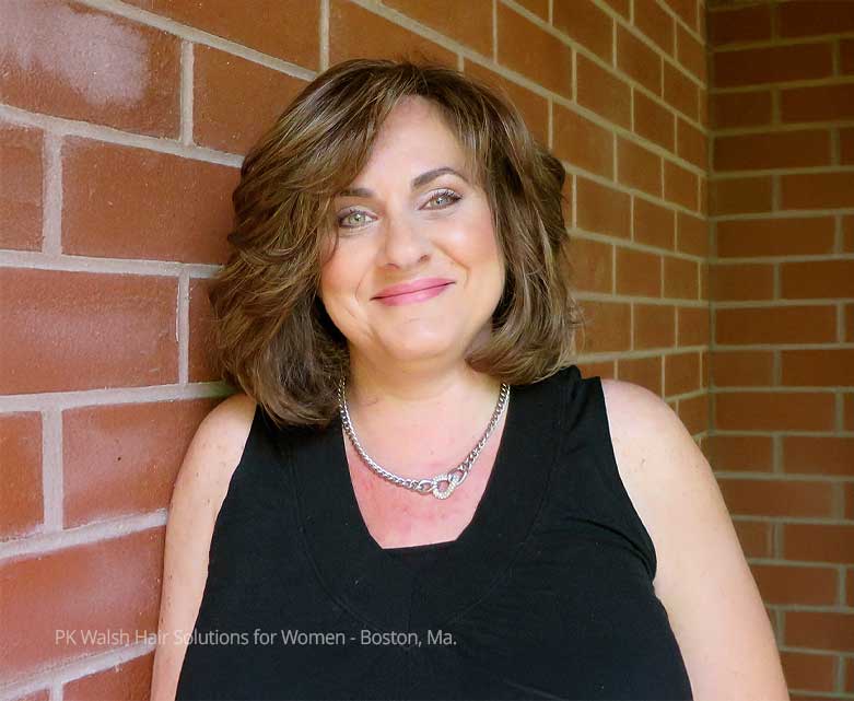 Before and after transformation showing increased density and confidence after women’s non-surgical hair replacement at PK Walsh in Boston Massachusetts