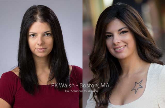 Providence RI womens hair solutions for Thinning Hair Boston MA