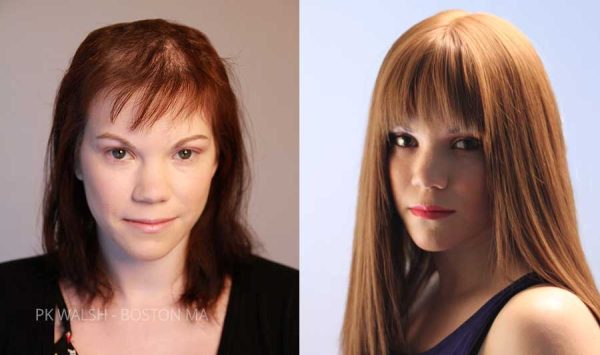 womens alopecia wigs female hair loss solutions pk walsh boston ma