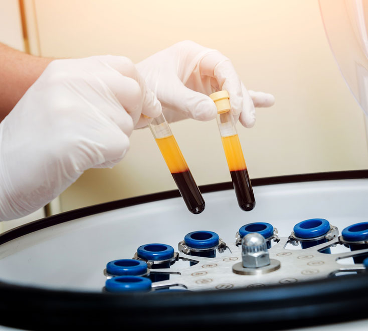 prp hair loss treatment for men boston ma