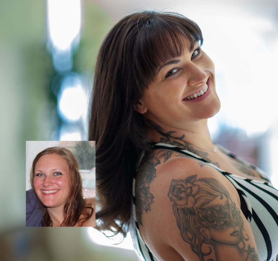 womens non-surgical hair replacement results pk walsh